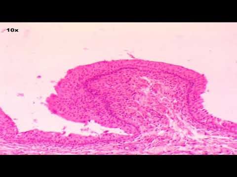 SLIDE: Epithelial Practice Quiz 2