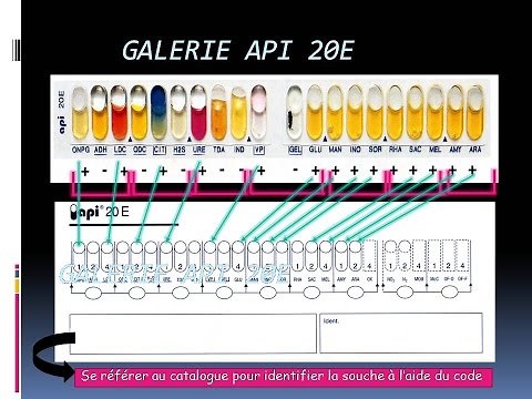 TP Galerie API 20E But principe et lecture