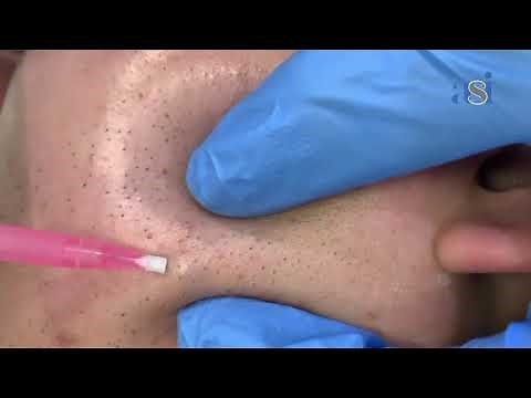 Introductions to PDO Mono threads