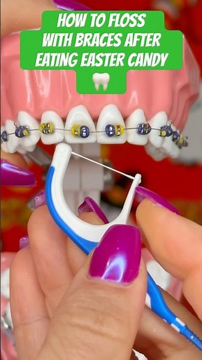 HOW TO FLOSS WITH BRACES AFTER EASTER EASTER CANDY 🧐🦷 #braces #easter #candy