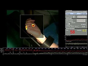 Remote photoplethysmography to monitor blood volume changes