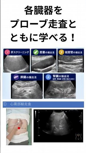 【#超音波検査】腹部エコー描出基本パック！【#はっとラボ】