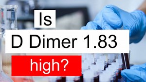 Is D Dimer 1.83 high, normal or dangerous? What does D Dimer level 1.83 mean?