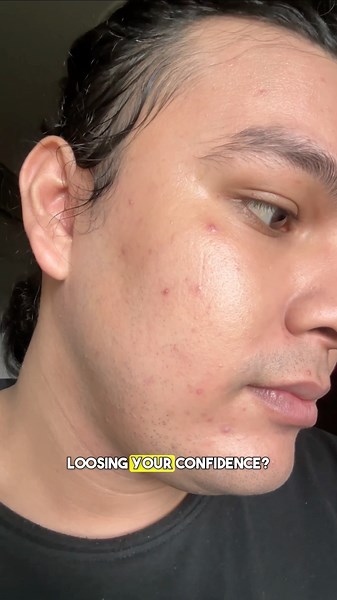 Garnier Men Acno Fight Face Wash Review #skincareroutine