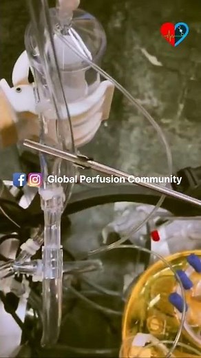 Cardiac Perfusionist | Cardiovascular perfusionists