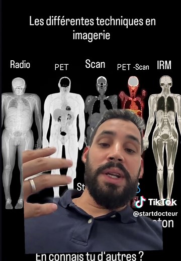 Imagerie Médicale : Explorer le Corps Humain
