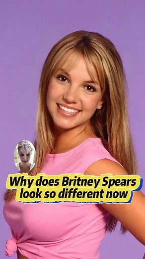 No wonder Britney Spears looks so different now compared to before celebrity fyp usatiktok usa britneyspears | Celeb Celebrity