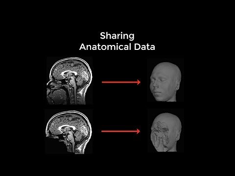 Anonymizing MRI Scans with mri_deface