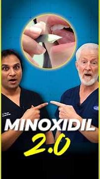 Sublingual Minoxidil: Beats Oral?