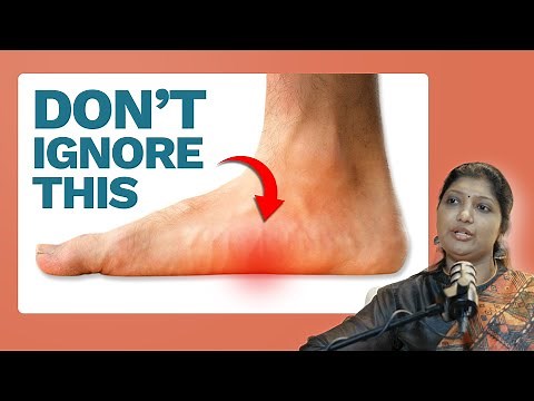 Why your Feet hurt & how to fix them? | Good Feet Podcast | by FootImpact