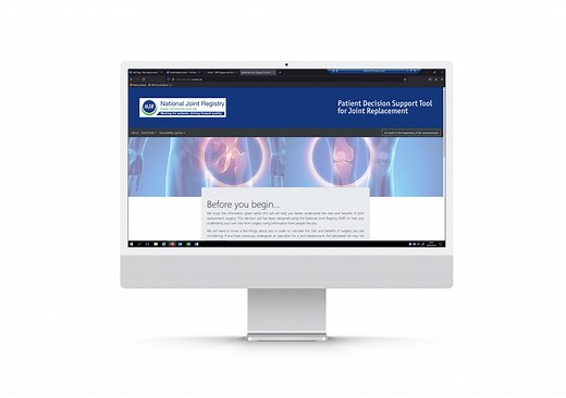 Patient Decision Support Tool (hip and knees)
