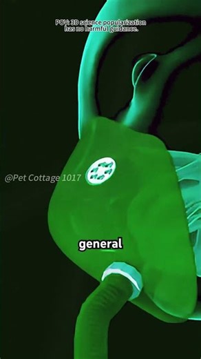 Percutaneous Nephrolithotomy (PCNL)(3D Animation)