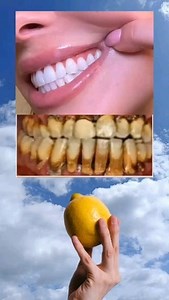 223K views · 8.3K reactions | The Perfect Tooth Brushing Routine: A Guide to a Healthier Smile Achieve a sparkling smile with our ultimate tooth brushing guide! 醴✨ Discover the secrets to proper brushing techniques, the best types of toothbrushes and toothpaste, and tips for maintaining oral hygiene. Watch now to ensure your teeth are as healthy as they are beautiful! #OralHygiene #HealthySmile #ToothBrushingTips | Natural Recipes | Facebook