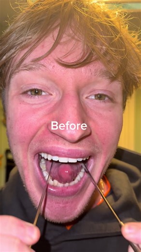 How to Care for Your Tongue: Tips from Spike