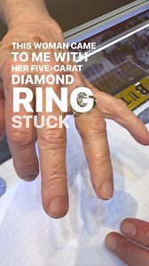 1.8K views · 15K reactions | Stuck Ring Rescue!This woman brought...