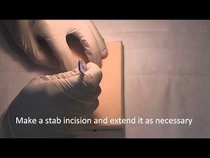 Foreign Body Removal