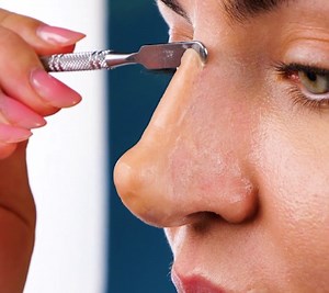 238K views · 607 reactions | Surprising Truths About Plastic Surgery & Aesthetic Treatments | Health is Wealth | Facebook