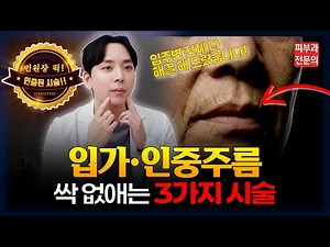 입술 위 인중 세로주름, 치마주름, 고양이 주름! 인중 없애는 가장 확실한 방법 3가지 (쥬브아셀, 울트라클리어)