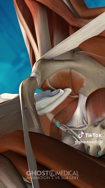 Coloplast’s Digitex Suture Delivery System is a tool that can help surgeons place #stitches in patients during surgery without seeing the area directly. Another important feature of the Digitex SDS is that it can reduce tissue damage. The tool places the stitches with a consistent tension and depth, which can help the wound heal better. Overall, the Digitex SDS is a tool that surgeons use to put stitches in their patients. It is easy to use and can be used with different types and sizes of stitc