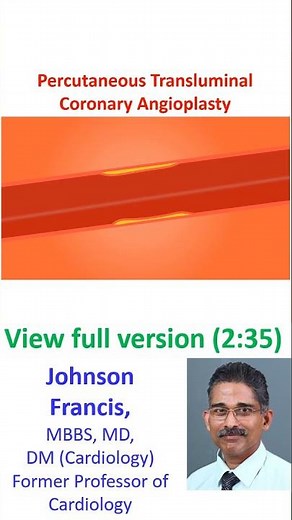 Percutaneous Transluminal Coronary Angioplasty (PTCA)