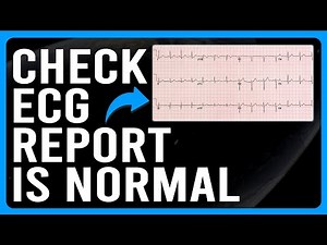 How to Check ECG Report is Normal (How to Check Your ECG Report for Normal Results?)