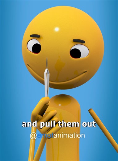 How to Remove a Splinter Effectively