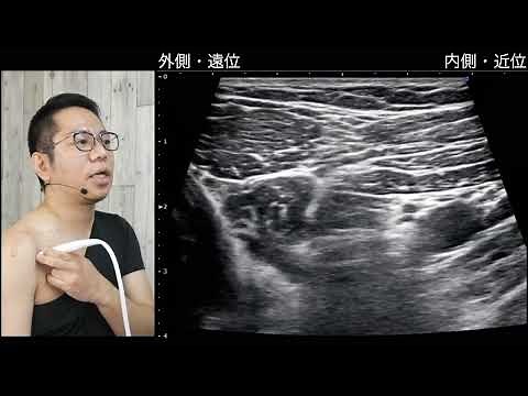 鎖骨下動脈② 鎖骨下