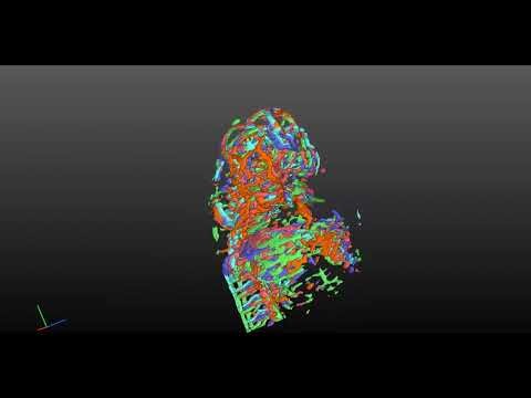 Image analysis using zebrafish vasculature quantification (ZVQ)