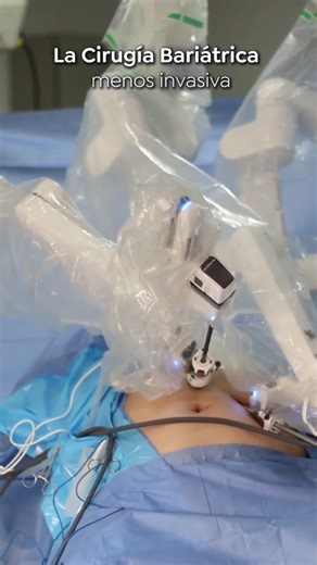 Robotic Bariatric Surgery in Colombia: Fewer Incisions and Express Recovery
