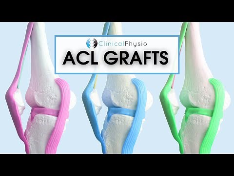 What are the different ACL Grafts? | Which one is best? Patella vs Hamstring