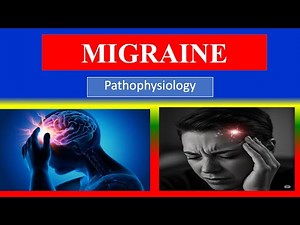 MIGRAINE - Definition , Pathophysiology Step By Step Process - Explained