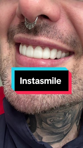 Transform Your Smile with InstaSmile Clip on Veneers