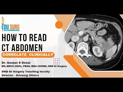 ABCT Mnemonic for CT Abdomen Interpretation | Gunjan Desai posted on the topic | LinkedIn