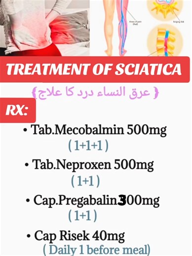 Manage Sciatic Pain: Causes, Symptoms, and Treatments