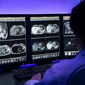 Abdominal/Body Radiology Fellowship (Arizona) - Residencies and Fellowships - Mayo Clinic College of Medicine & Science