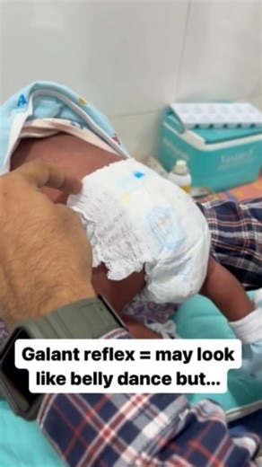 Pradeep Rathod | The Galant reflex, also known as the truncal incurvation reflex, is a primitive reflex in newborns that can be tested to help rule out... | Instagram