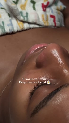 Melanie Lin 🤍 on Instagram: "Deep cleanse facial Inclusions : Skin Analysis Facial Cleanse Double Exfoliation Congestion Removal High Frequency 30 min LED THERAPY w Lip Mask Moisture Treatment Duration - 2 hours Book your facial now🧖‍♀️🫧 Link in bio 🔗 •••••••• •••••••• •••••••• Limited availability 🗓️ • • • • • • #nyclashtech #nyclashartist #nyclashes #lashgirl #nyclashes #nycbeauty #lashboss #nyceyelash #lashtextured #lashartist #bronxlashtech #bronxlashartist #harlemlashartist #harlemlash