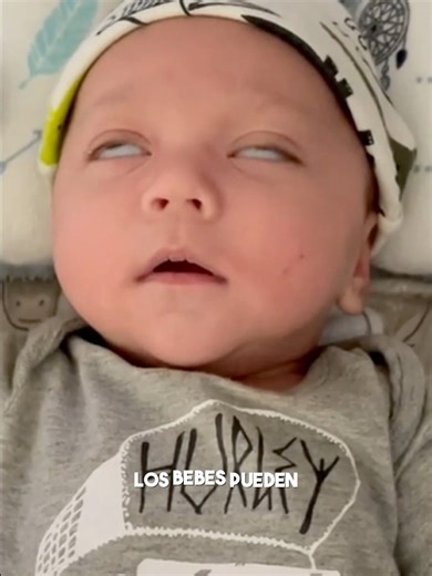 3M views · 67K reactions | Reacciones naturales del recién nacido por las que no debes preocuparte #bebes #desarrollodelbebe #bebellora #bebeencamino #tengounbebe #tendreunbeb #madrepeimeriza #todosobrebebes #SereMama #serepapa #reciennacidos | Sub especialidades Pediátricas San Borja | Facebook