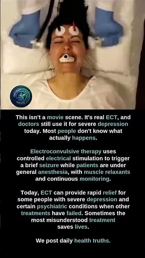 The Truth About "Shock Therapy" 🧠