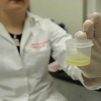 Video: The α-test: Rapid Cell-free CD4 Enumeration Using Whole Saliva