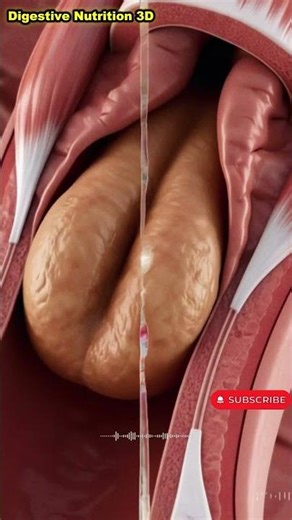Inside a Constipated Colon 😳 You Won’t Believe This! | Gut Health Explained