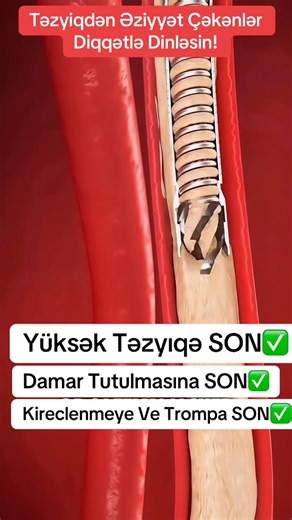 101 reactions · 12 shares | 0553249392-DAMAR TUTULMASINA SON- XOLİKAN...