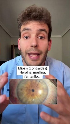 Examining your pupils is important #funfacts #eyes #emergency