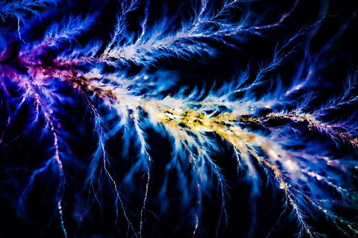 Lightning strike survivors describe what 100 million volts feels like