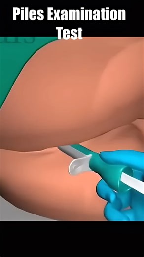 Comprehensive Guide to Piles Examination Tests