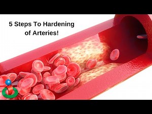 5 Things That Happen With Hardening of Arteries!
