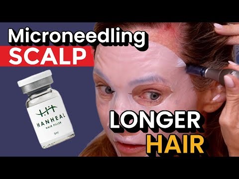Regrow Hair? Scalp Microneedling With Dr. Pen A7 + Hanaheal Hair Filler
