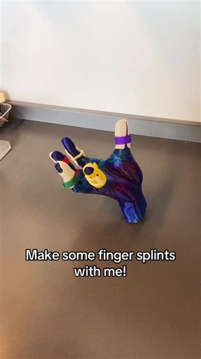 Just a few finger splints we make in the clinic. Let me know if you have any questions on any! #occupationaltherapy #fracture #handtherapy #splint