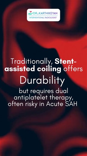 Stent-assisted coiling provides strong durability, but dual antiplatelet therapy can be risky in acute SAH. Choosing the safest approach depends on timing, anatomy, and clinical stability. #NeuroIntervention #BrainAneurysm #StentAssistedCoiling #InterventionalRadiology #SAHManagement #MedicalEducation | Dr Karthi Interventional Radiology