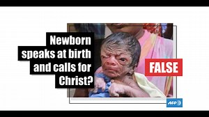 This baby with progeria syndrome did not speak at birth